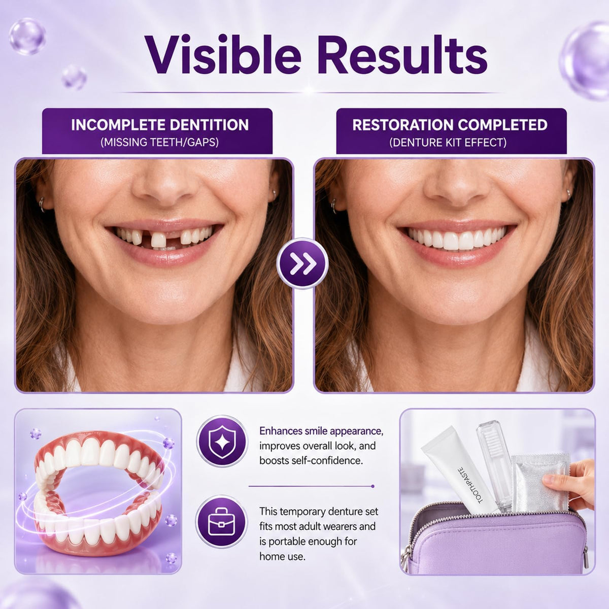 Heat Moldable Temporary Denture Kit 1 Set B367